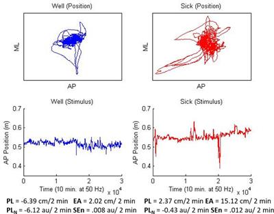 Responding to Other People’s Posture: Visually Induced Motion Sickness From Naturally Generated Optic Flow